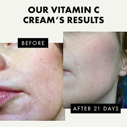 Vitamin C Face Moisturizer - Skin Whitening Cream Hyaluronic Acid Face Cream Brightening Cream Lotion - Vitamin C Facial Moisturizer - Dark Spot Remover for Face Morning Night Cream & Radiant Skin