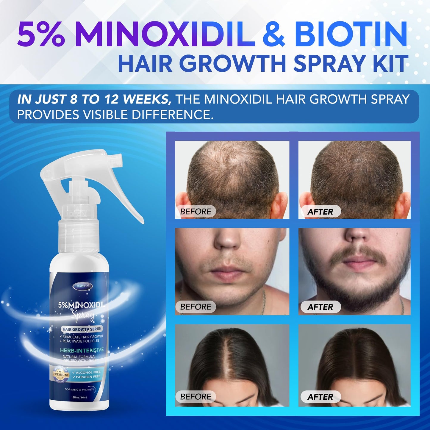 5% Minoxidil for Men, Minoxidil Spray, Minoxidil for Women Hair Growth, Minoxidil for Men Beard Growth, Hair Regrowth for Men, Minoxidil 5 Percent, Hair Loss Treatments for Women 60ml * 3bottles