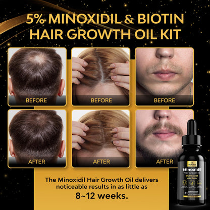 5% Minoxidil for Men Hair, Minoxidil for Women Hair Growth, Minoxidil for Men Beard Growth, Minoxidil 5 Percent, Hair Regrowth for Men, Hair Loss Treatments for Women 1oz